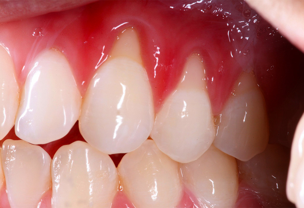 EST306-PERIODONCIA I (ODO) - G3/2026